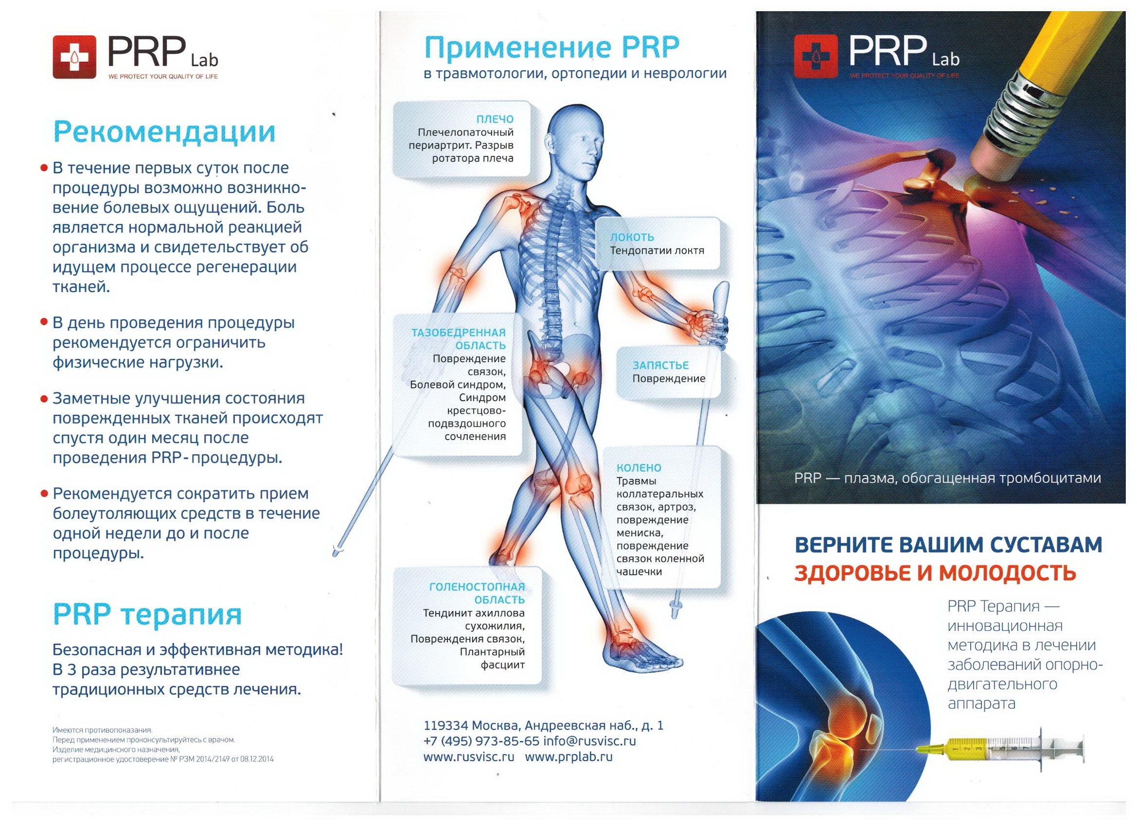Процедура плазмолифтинга для суставов. Плазмолифтинг PRP терапия коленного сустава. PRP терапия плазма в коленный сустав. Плазмотерапия суставов (PRP-терапия, плазмолифтинг). Плазмотерапия плазма коленного сустава.